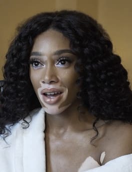 Photo of Winnie Harlow