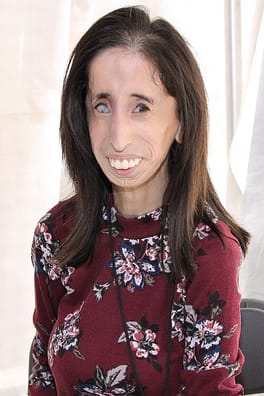 Photo of Lizzie Velasquez